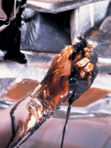 Hand Covered in Dirty Oil